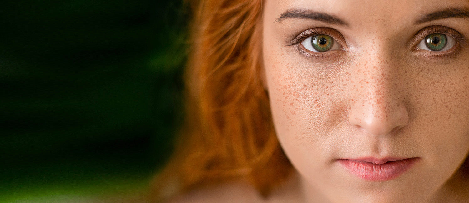Manchas en tu piel: te damos los mejores tips para cuidarte